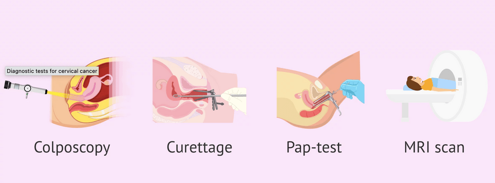 cervical_cancer_diagnosis